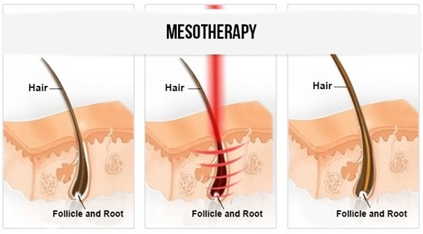 31724290122 - 헤어온의원