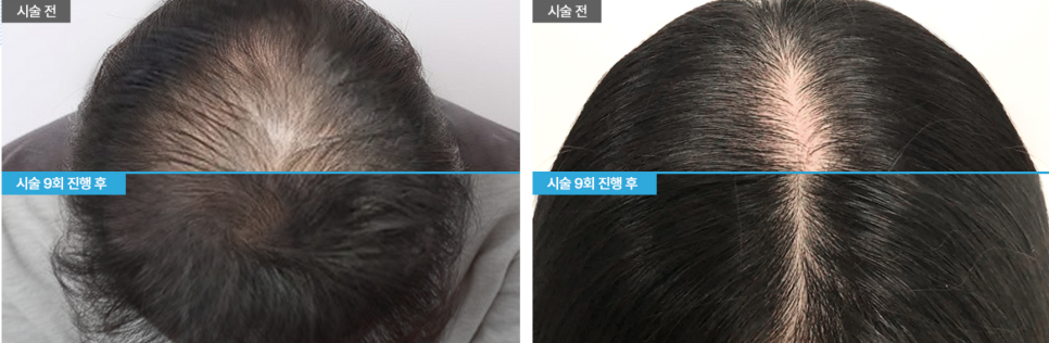 71724290137 - 헤어온의원