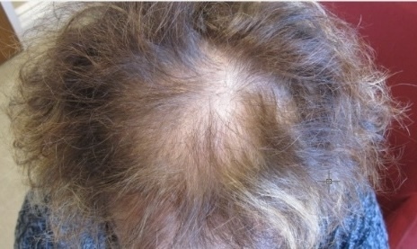 before after hair dye1721979835 - 헤어온의원