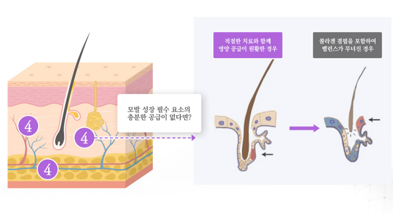image1719213472 - 헤어온의원