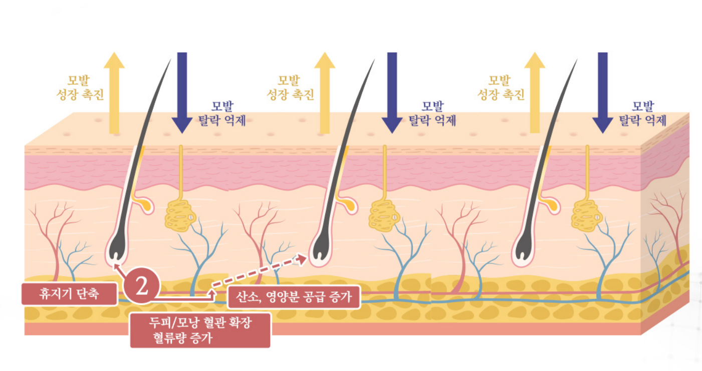 image21721977588 - 헤어온의원