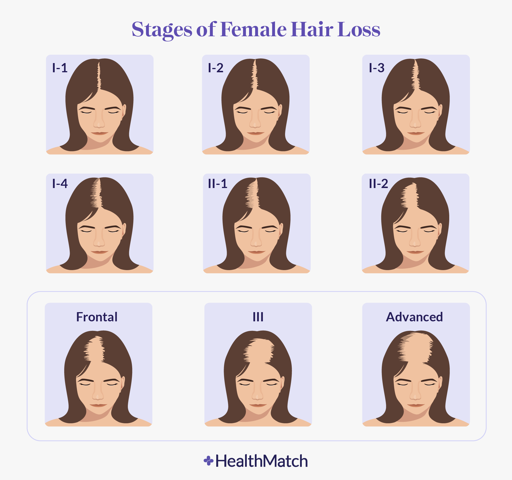 womenhairloss 01 011721356092 - 헤어온의원