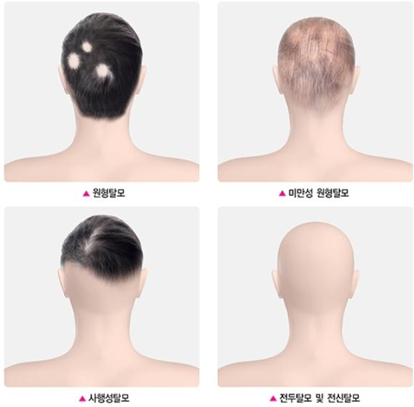 31739244639 - 헤어온의원