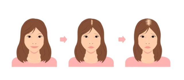 41739243654 - 헤어온의원