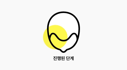 약물로 추가 진행을 억제하면서, 밀도나 헤어라인을 보완하는 치료 전략을 함께 고려
