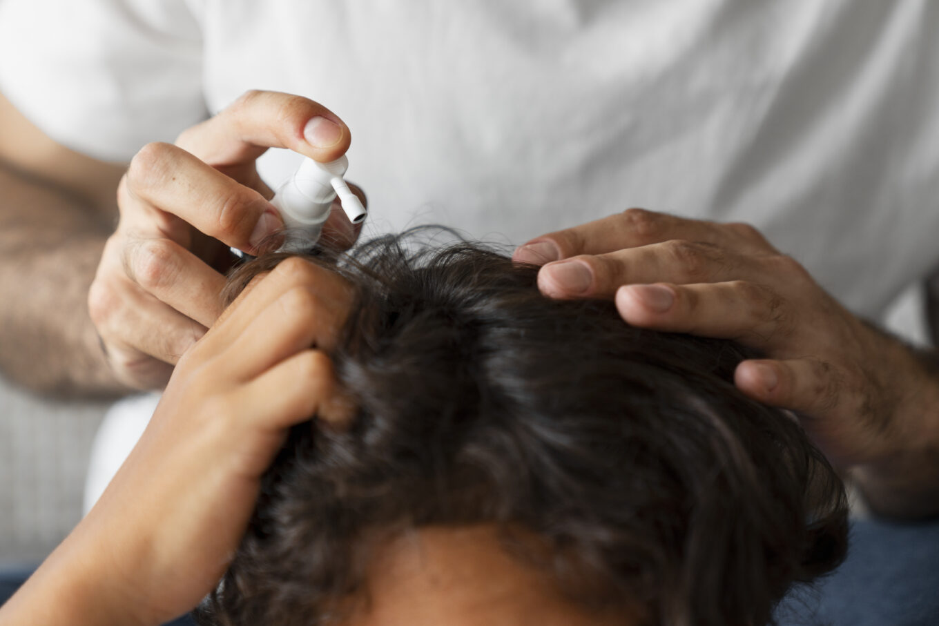 high angle hand holding lice treatment - 헤어온의원